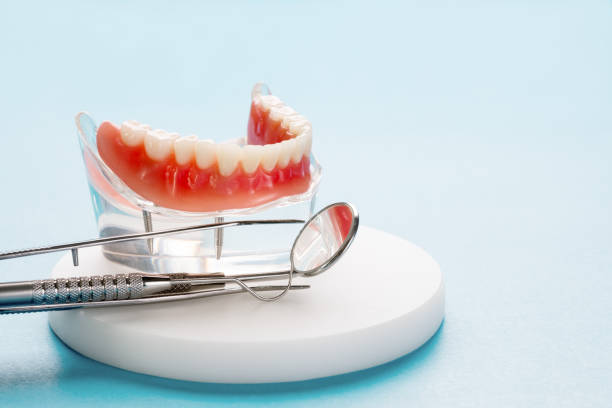 Best Teeth Whitening  in Bret Harte, CA