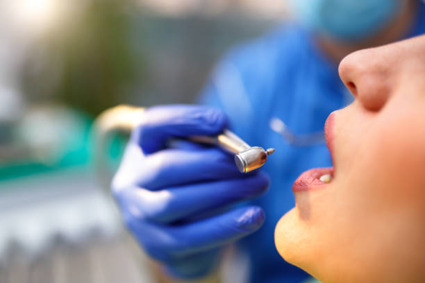 Best Root Canal Treatment  in Bret Harte, CA